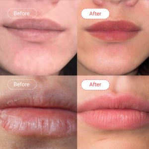 LIP CARE lip treatment 1.png