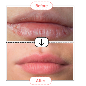 lip treatment balm.png