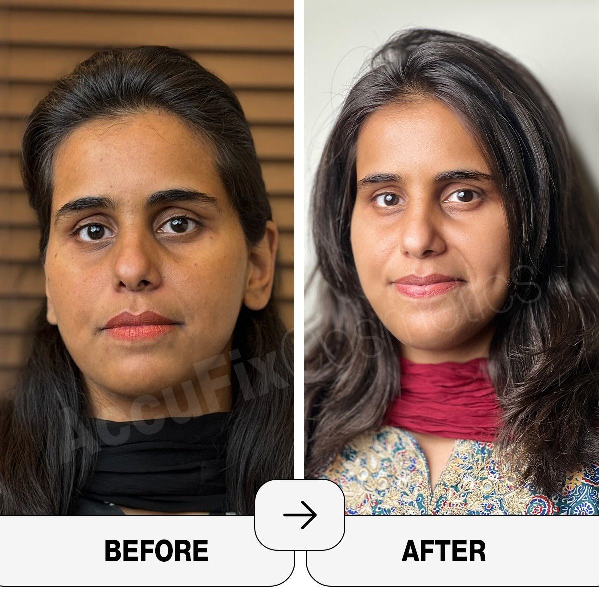 glycolic acid before and after.jpg glycolic acid before and after.jpg